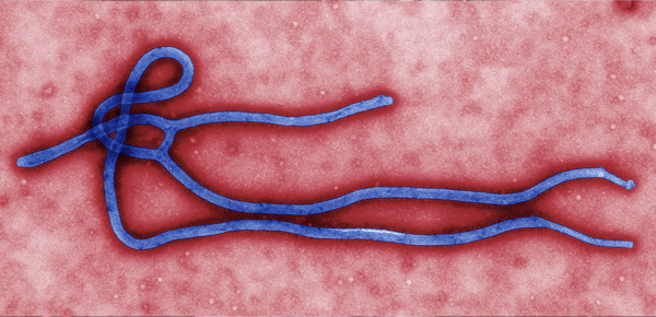 Colorized transmission electron micrograph (TEM) of an Ebola virus virion reveals some of its ultrastructural morphology. Image courtesy Cynthia Goldsmith, CDC.